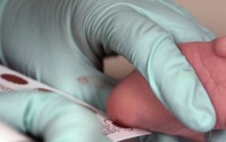 Фото: Скрининг на муковисцидоз